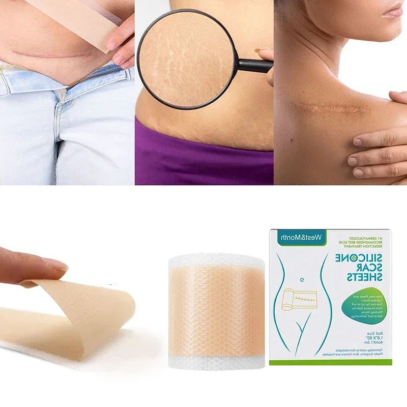 Miniatura 3 de Cinta De Silicona Para Quitar Cicatrices